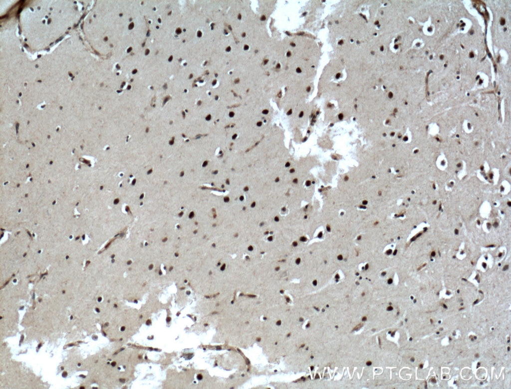 Immunohistochemistry (IHC) staining of human brain tissue using ASCL1 Polyclonal antibody (23751-1-AP)