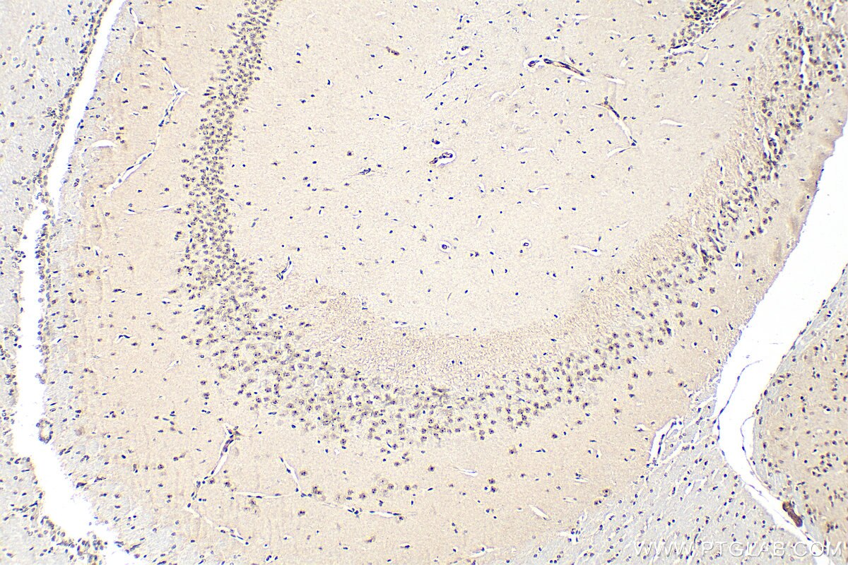 Immunohistochemistry (IHC) staining of mouse brain tissue using ASCL1 Polyclonal antibody (31206-1-AP)