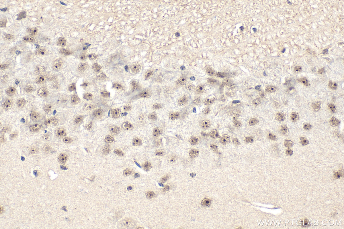 Immunohistochemistry (IHC) staining of mouse brain tissue using ASCL1 Polyclonal antibody (31206-1-AP)
