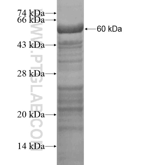 ASCL1 fusion protein Ag19360 SDS-PAGE
