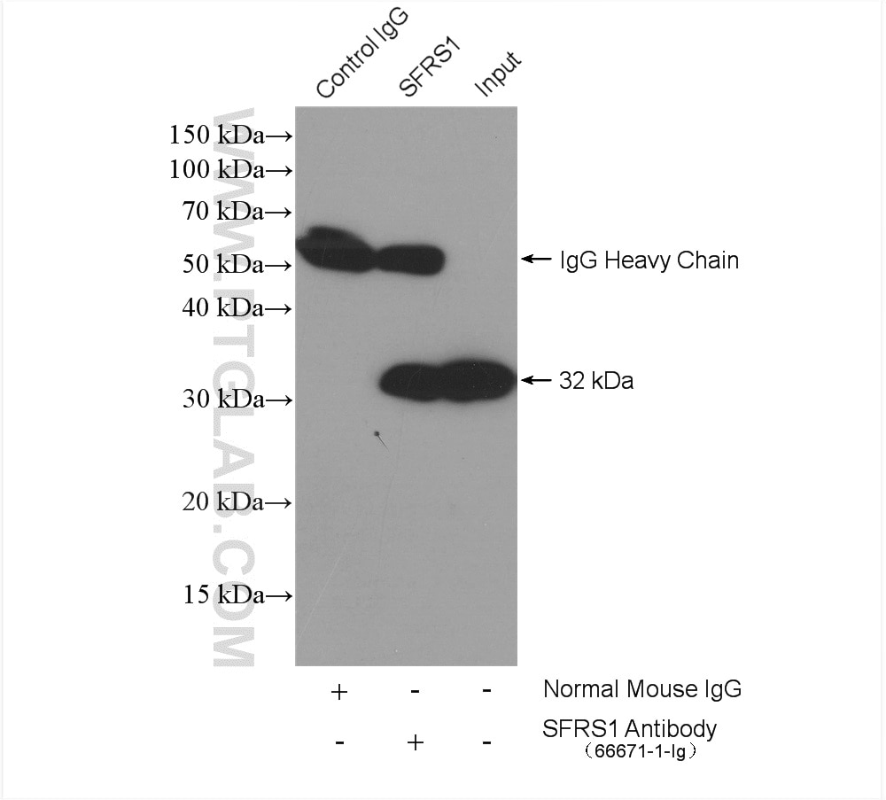 Immunoprecipitation (IP) experiment of HeLa cells using ASF/SF2 Monoclonal antibody (66671-1-Ig)