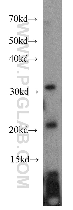 ASF1A-specific