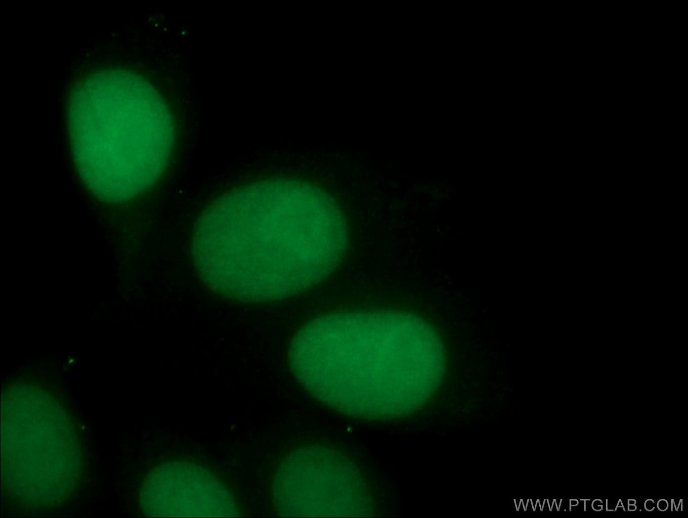 Immunofluorescence (IF) / fluorescent staining of HepG2 cells using ASF1A Monoclonal antibody (66884-1-Ig)