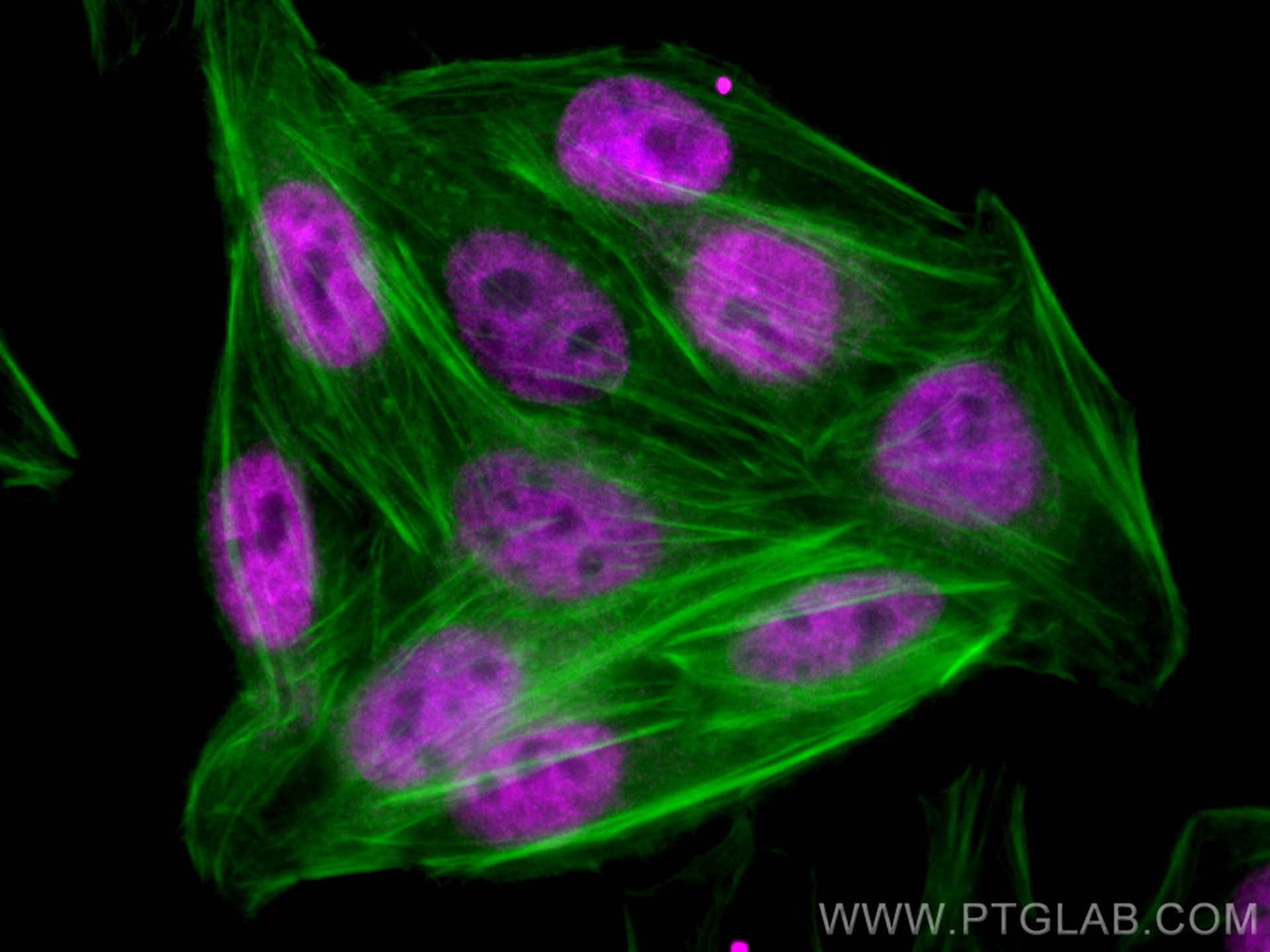 Immunofluorescence (IF) / fluorescent staining of HepG2 cells using ASF1A Monoclonal antibody (66884-1-Ig)