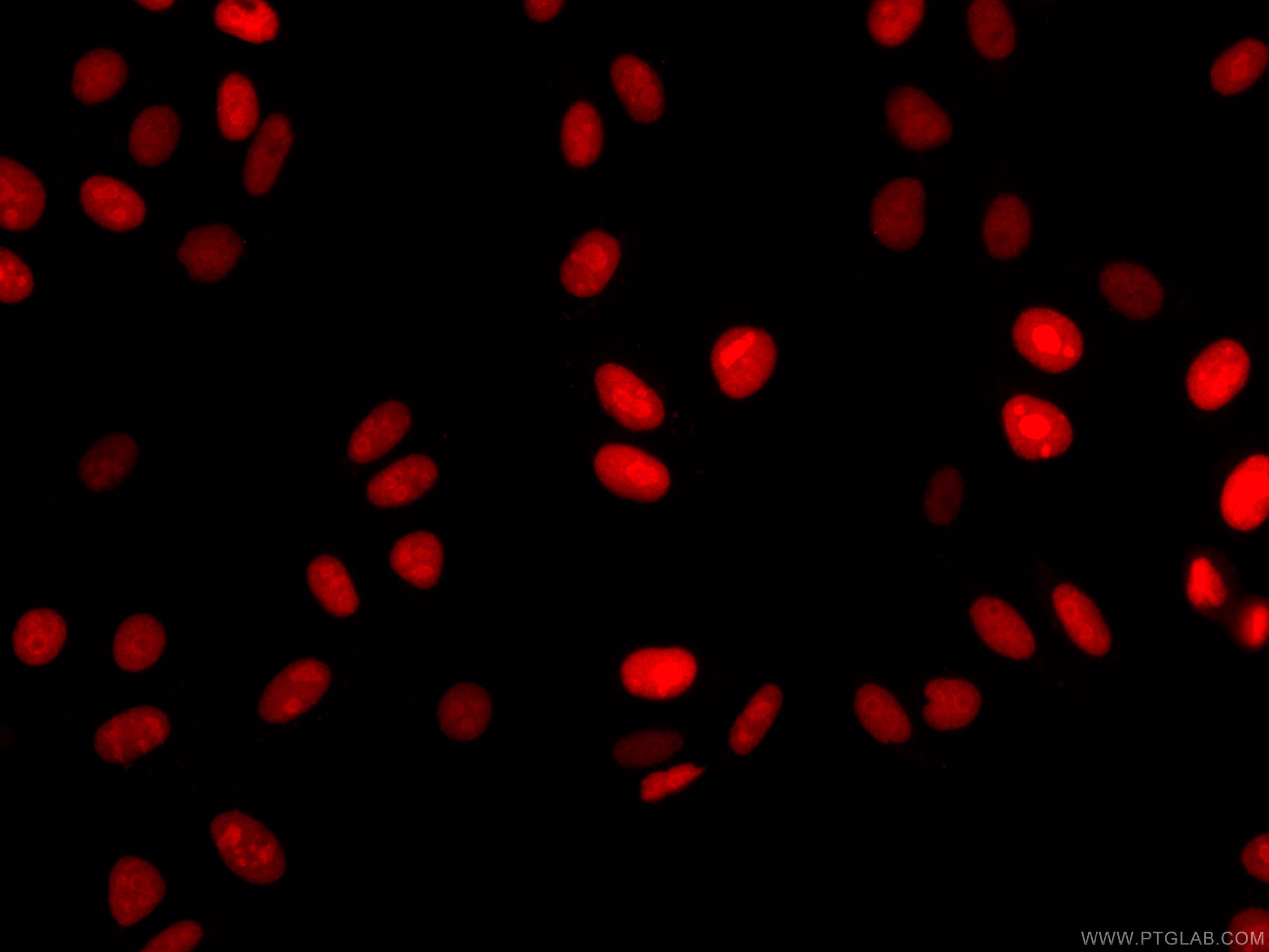 Immunofluorescence (IF) / fluorescent staining of HepG2 cells using CoraLite®594-conjugated ASF1A Monoclonal antibody (CL594-66884)