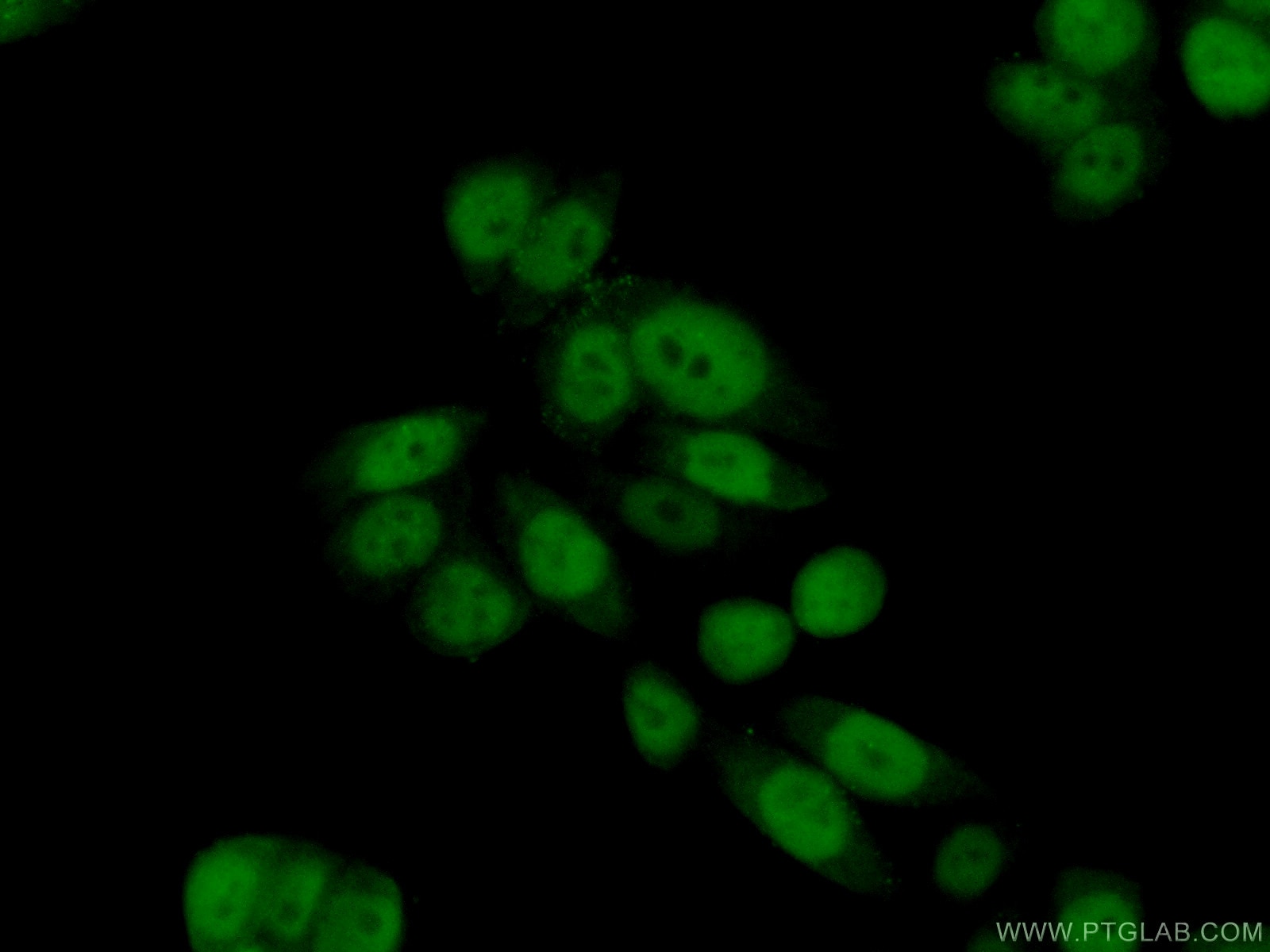Immunofluorescence (IF) / fluorescent staining of HeLa cells using ASF1A/B Polyclonal antibody (11011-1-AP)