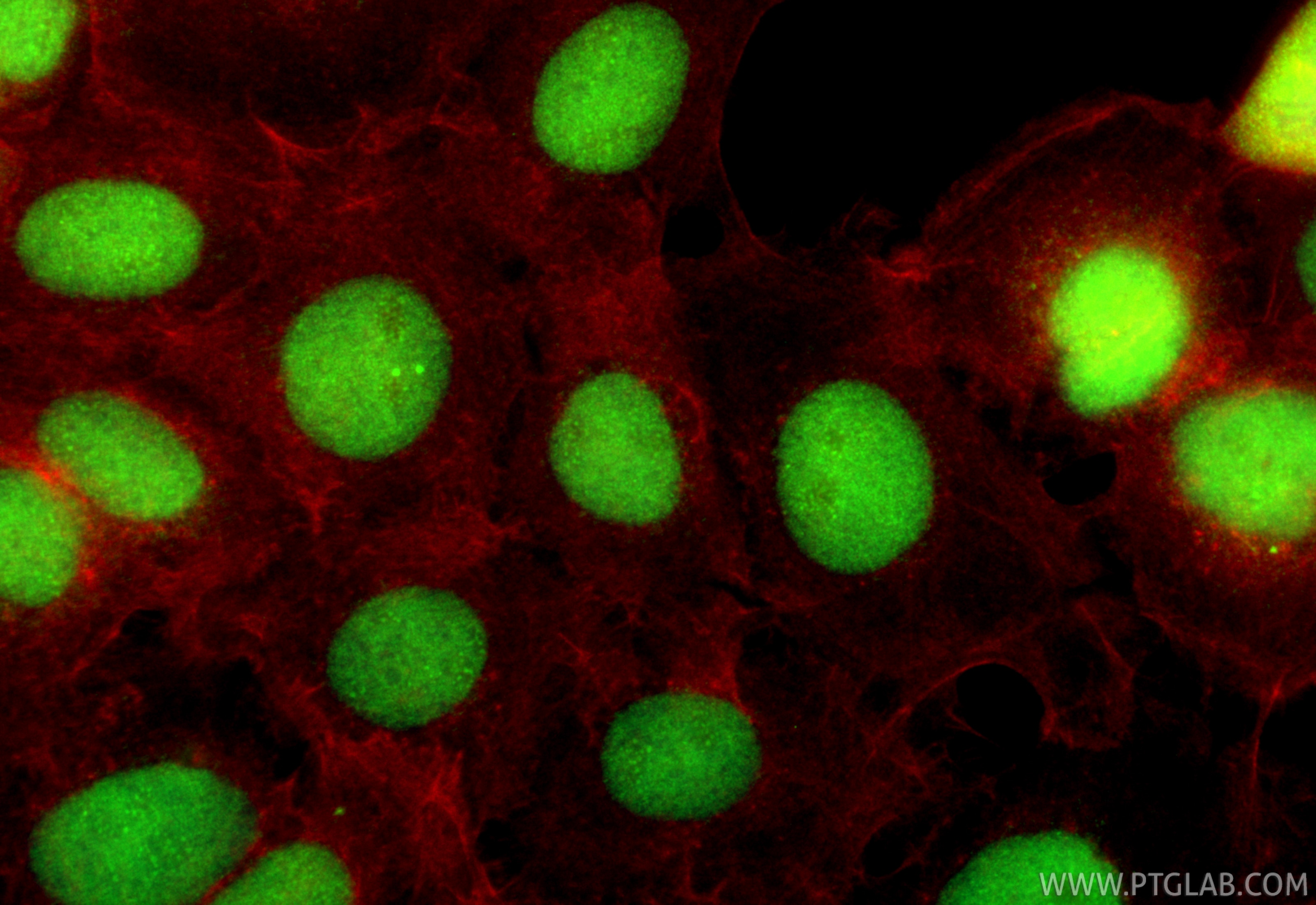 Immunofluorescence (IF) / fluorescent staining of A431 cells using ASF1A/B Polyclonal antibody (11011-1-AP)