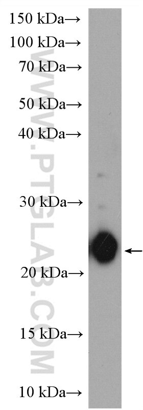 Western Blot (WB) analysis of mouse thymus tissue using ASF1A/B Polyclonal antibody (11011-1-AP)