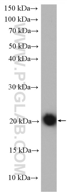 WB analysis of mouse thymus using 11011-1-AP