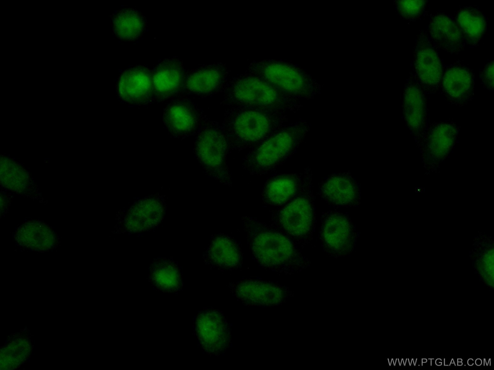 Immunofluorescence (IF) / fluorescent staining of HeLa cells using ASF1B-specific Polyclonal antibody (22258-1-AP)