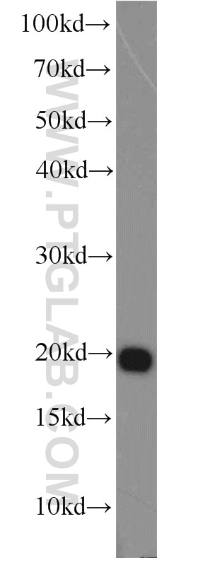 ASF1B-specific