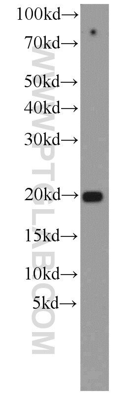 Western Blot (WB) analysis of A431 cells using ASF1B-specific Polyclonal antibody (22258-1-AP)