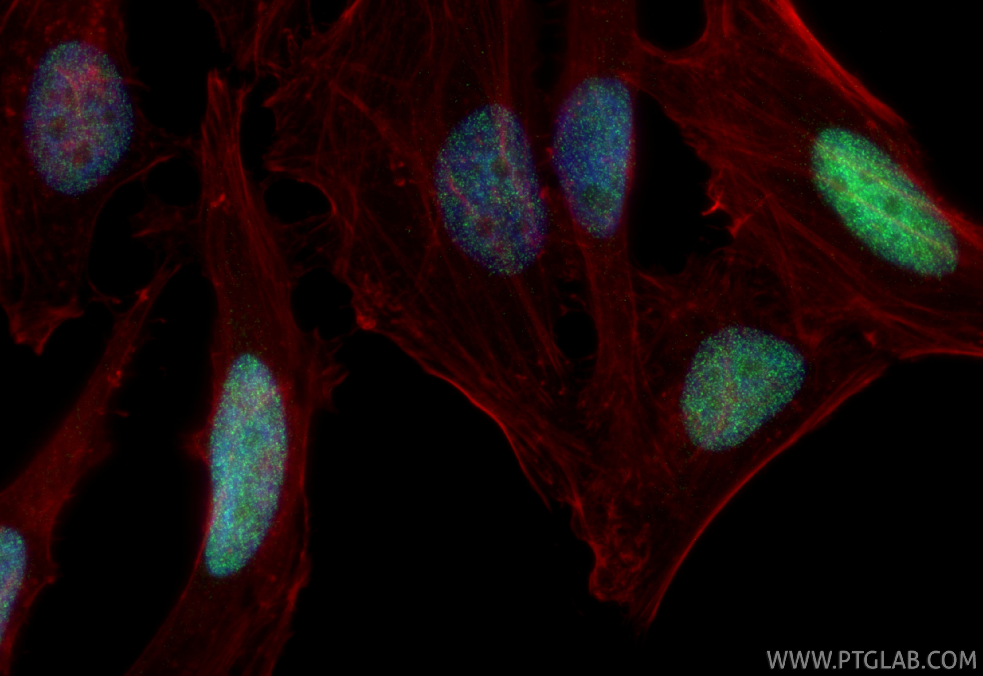 Immunofluorescent analysis of (4% PFA) fixed HeLa cells using ASF1B antibody (85848-1-RR, Clone: 250195A7 ) at dilution of 1:1000 and CoraLite®488-Conjugated Goat Anti-Rabbit IgG(H+L) (SA00013-2), CL594-Phalloidin (red). This data was developed using the same antibody clone with 85848-1-PBS in a different storage buffer formulation. Immunofluorescence (IF) / fluorescent staining of HeLa cells using ASF1B Recombinant monoclonal antibody (85848-1-RR)