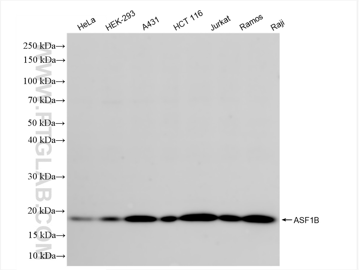 Western Blot (WB) analysis of various lysates using ASF1B Recombinant antibody (85848-1-RR)
