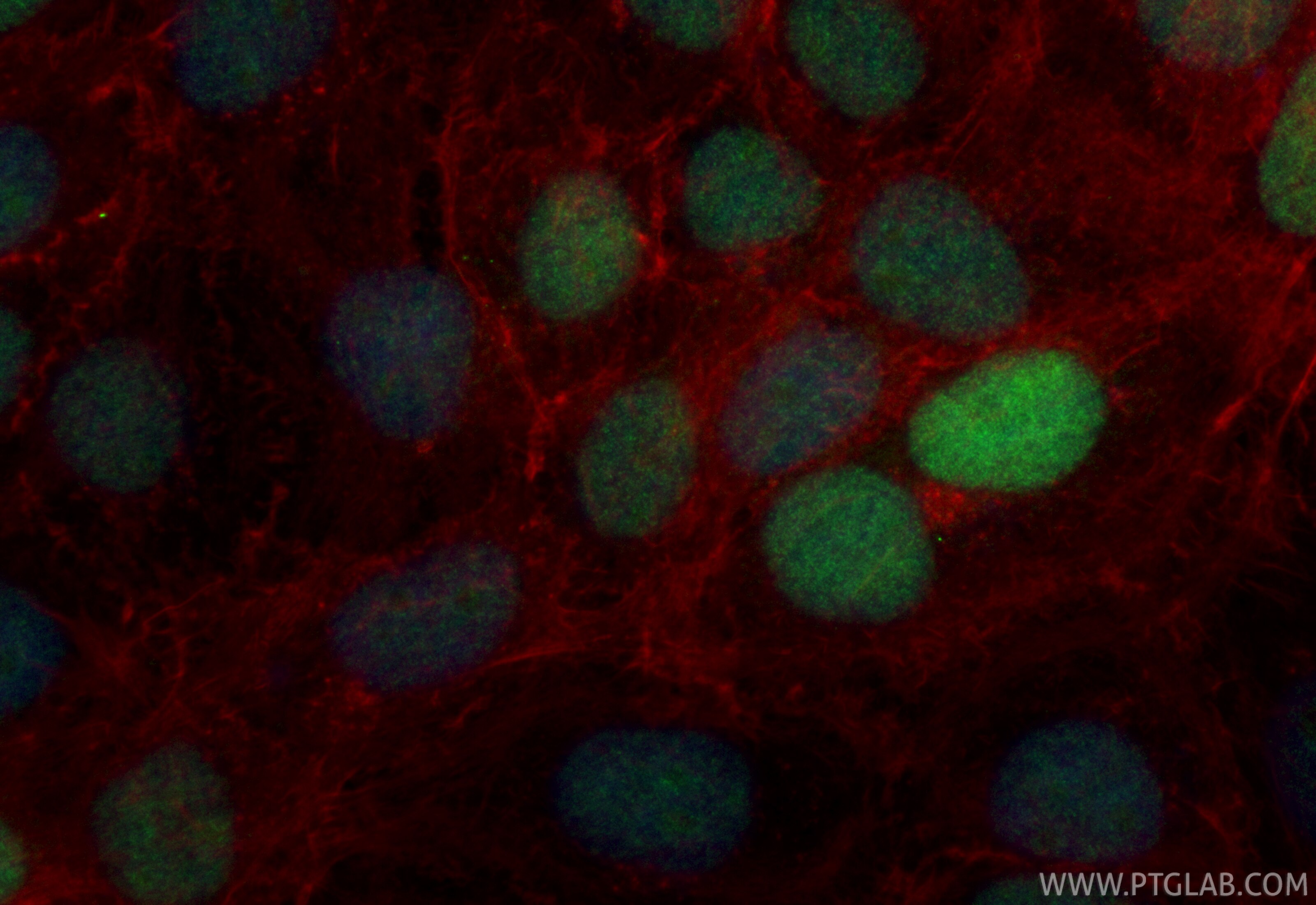 Immunofluorescent analysis of (4% PFA) fixed A431 cells using CoraLite® Plus 488 ASF1B antibody (CL488-85848, Clone: 250195A7 ) at dilution of 1:200, CL594-Phalloidin (red). Immunofluorescence (IF) / fluorescent staining of A431 cells using CoraLite® Plus 488-conjugated ASF1B Recombinant mo (CL488-85848)