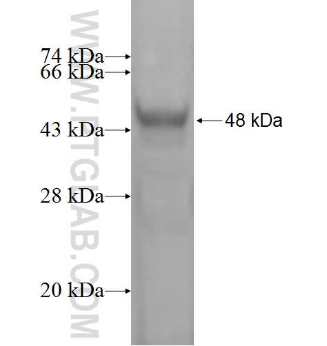 ASF1B fusion protein Ag1477 SDS-PAGE