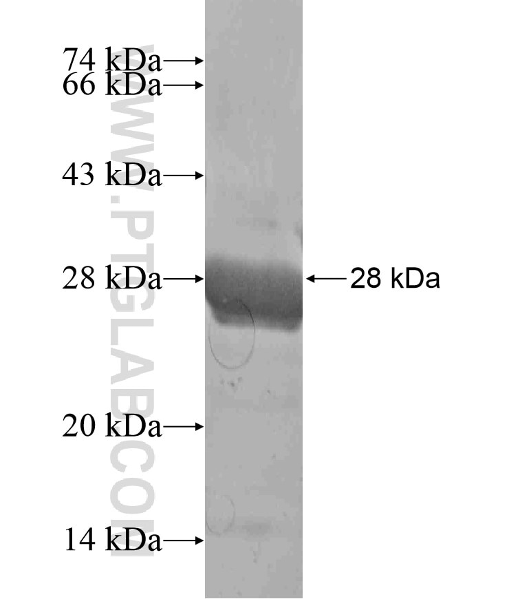 ASF1B fusion protein Ag17763 SDS-PAGE