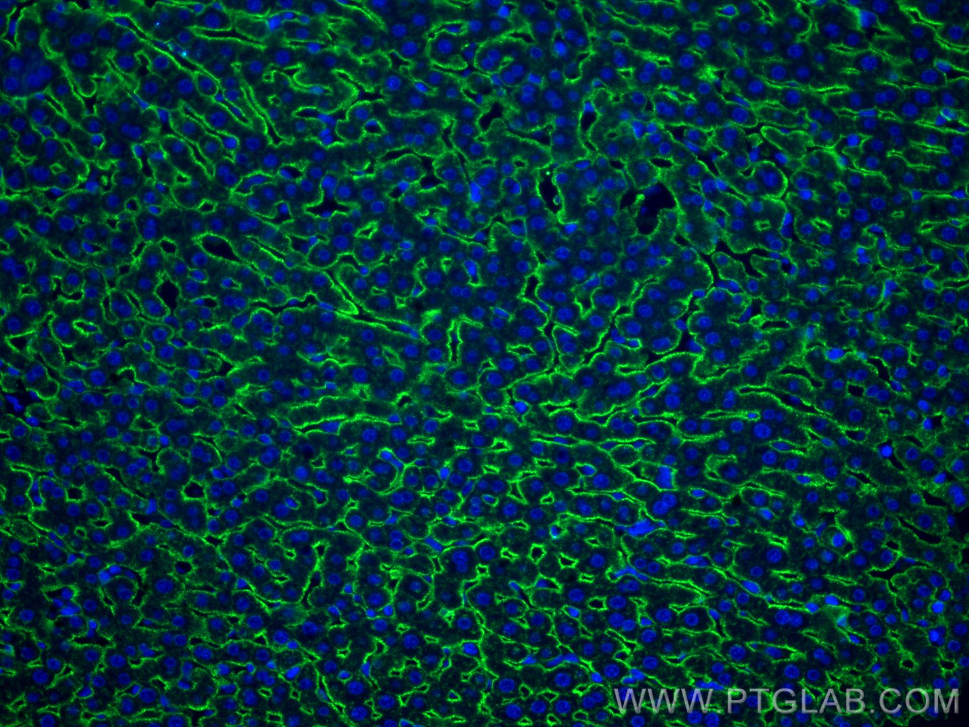 Immunofluorescence (IF) / fluorescent staining of rat liver tissue using ASGR1 Polyclonal antibody (11739-1-AP)