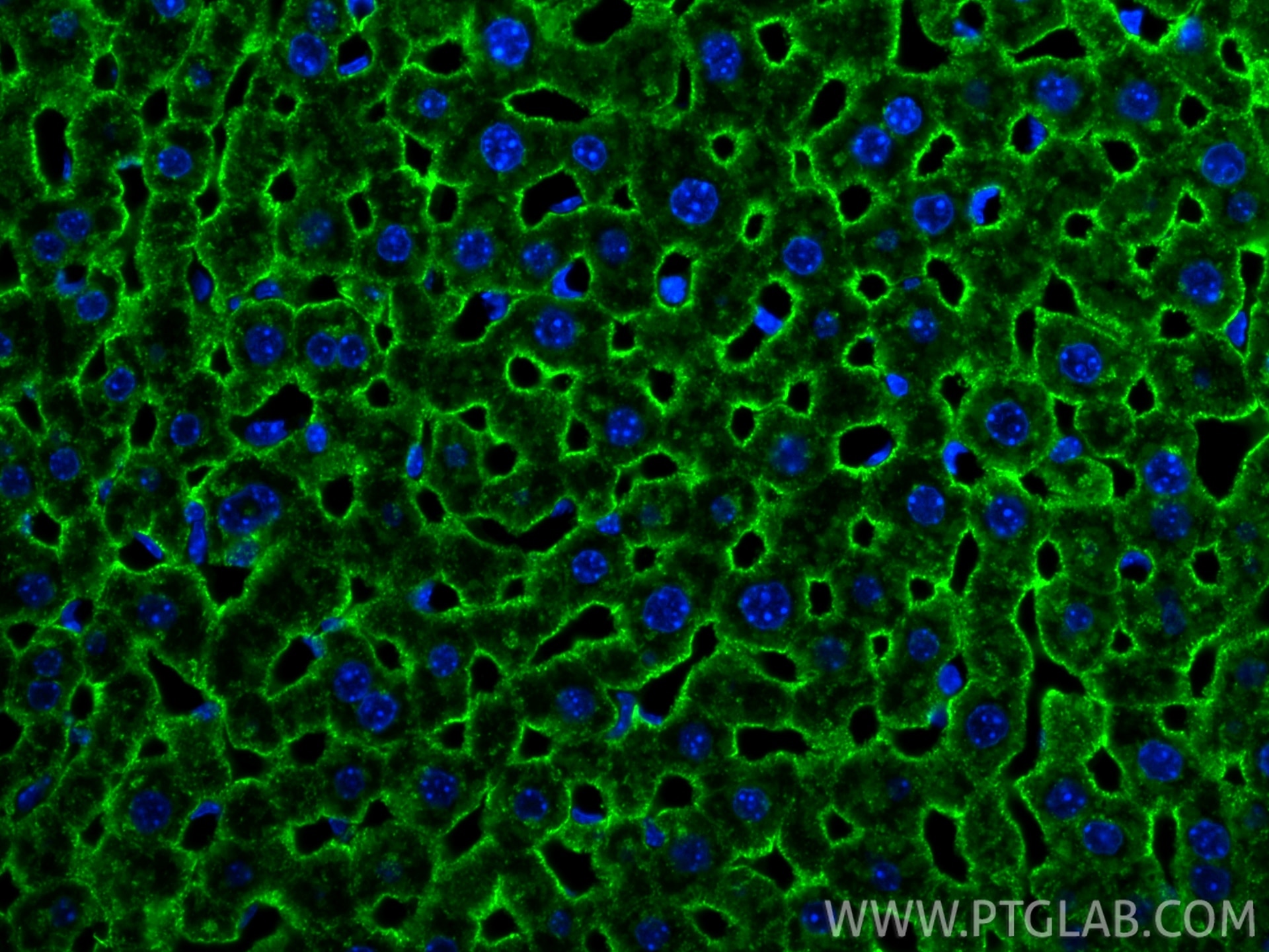 Immunofluorescence (IF) / fluorescent staining of mouse liver tissue using ASGR1 Polyclonal antibody (11739-1-AP)
