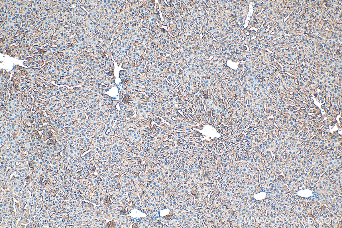 Immunohistochemistry (IHC) staining of rat liver tissue using ASGR1 Polyclonal antibody (11739-1-AP)