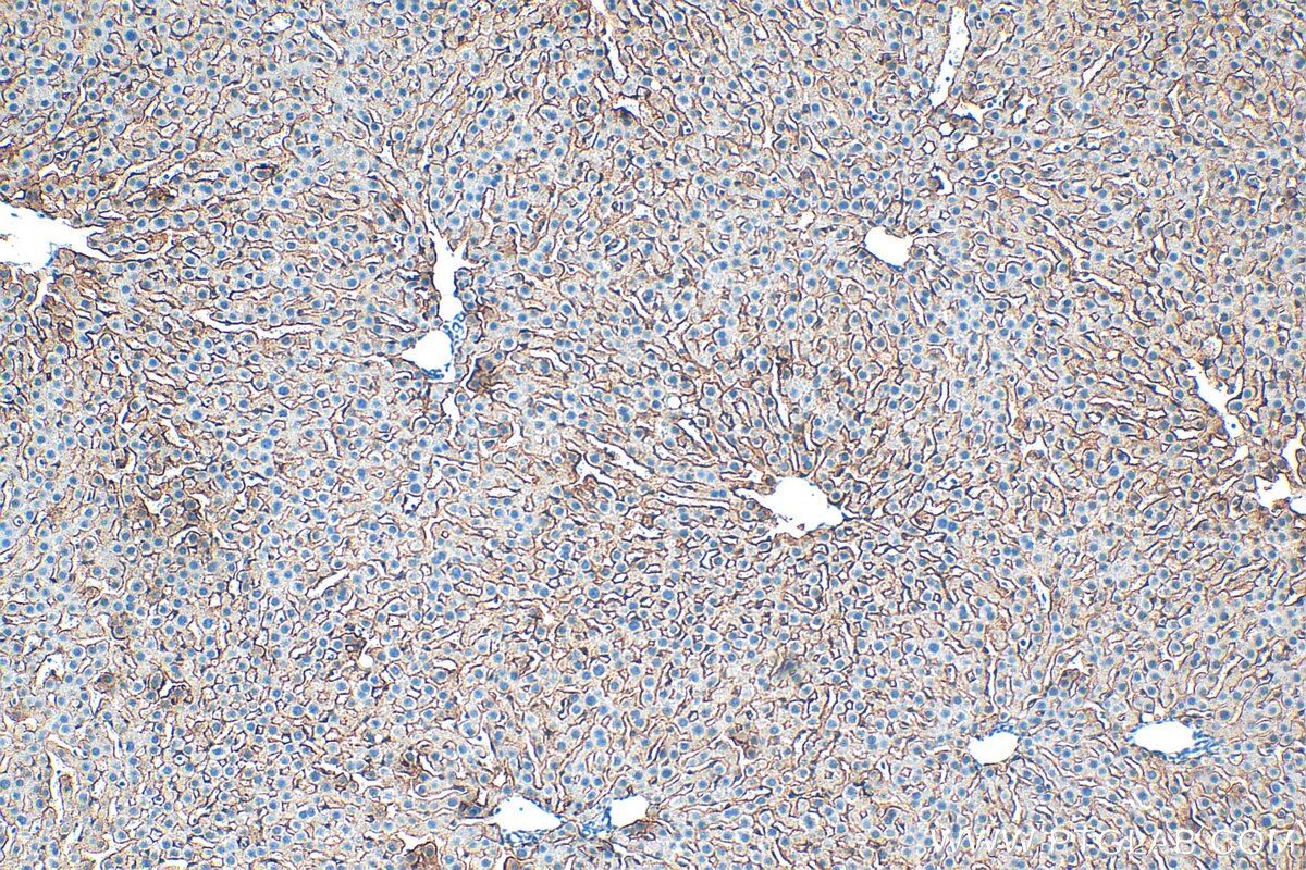 Immunohistochemistry (IHC) staining of rat liver tissue using ASGR1 Polyclonal antibody (11739-1-AP)