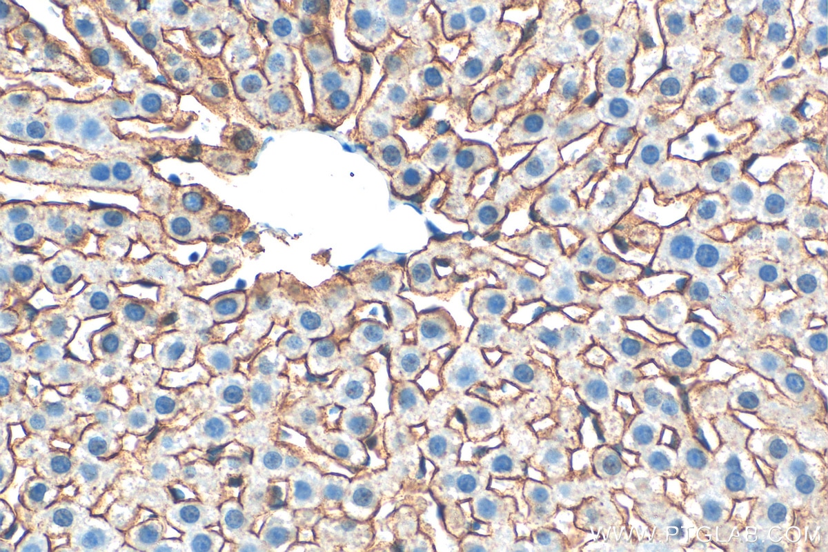 Immunohistochemistry (IHC) staining of rat liver tissue using ASGR1 Polyclonal antibody (11739-1-AP)