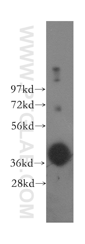 Western Blot (WB) analysis of human liver tissue using ASGR1 Polyclonal antibody (11739-1-AP)