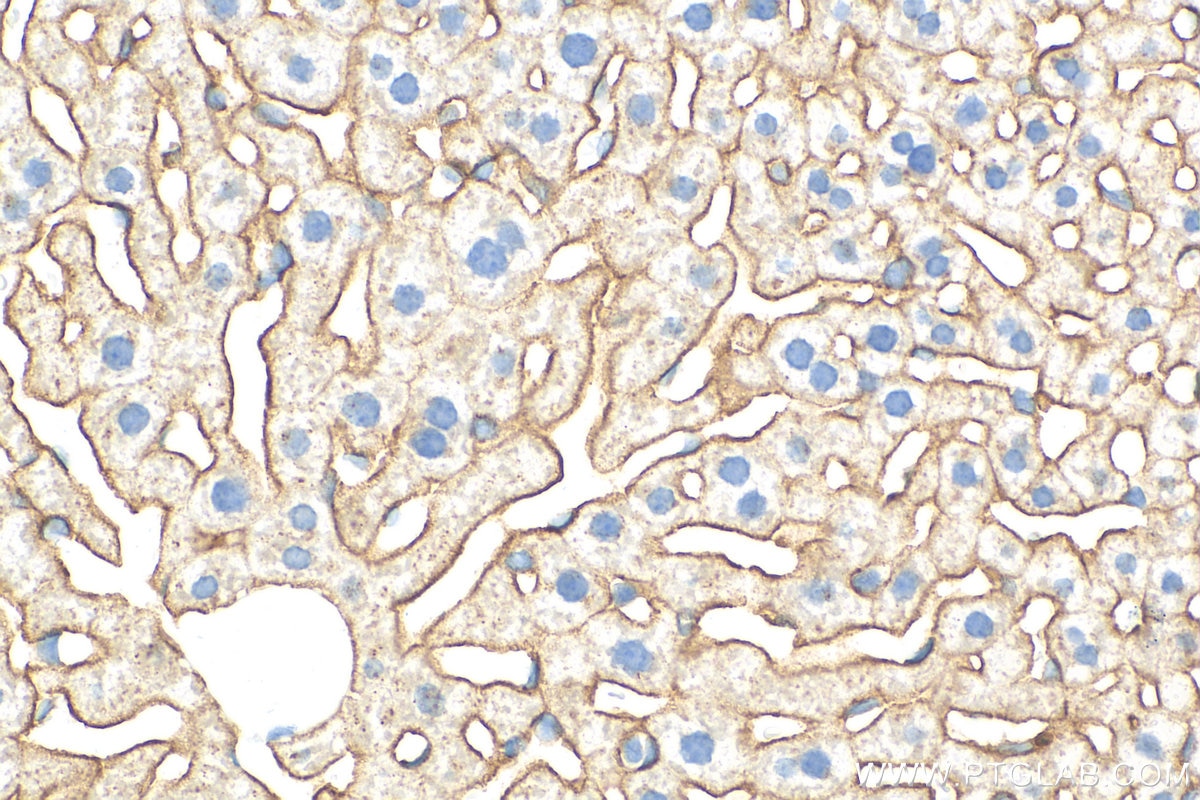 Immunohistochemistry (IHC) staining of mouse liver tissue using ASGR1 Polyclonal antibody (31338-1-AP)