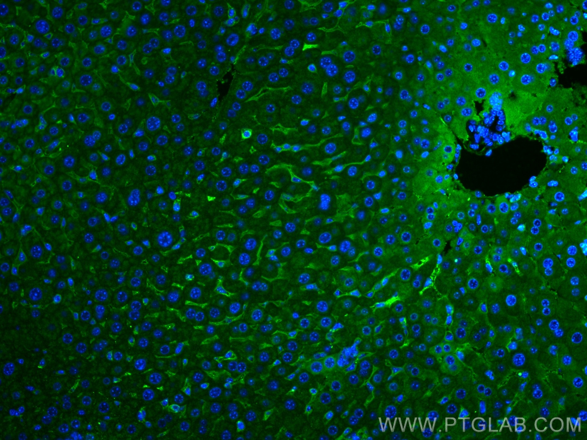 Immunofluorescence (IF) / fluorescent staining of mouse liver tissue using ASGR1 Monoclonal antibody (66692-1-Ig)