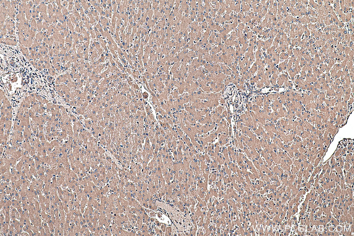 Immunohistochemistry (IHC) staining of human liver tissue using ASGR1 Monoclonal antibody (66692-1-Ig)