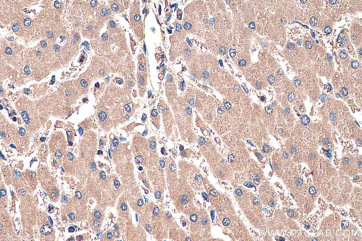 Immunohistochemistry (IHC) staining of human liver tissue using ASGR1 Monoclonal antibody (66692-1-Ig)