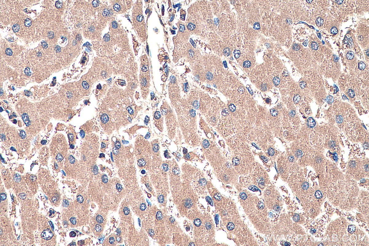 IHC staining of human liver using 66692-1-Ig