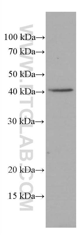 ASGR1