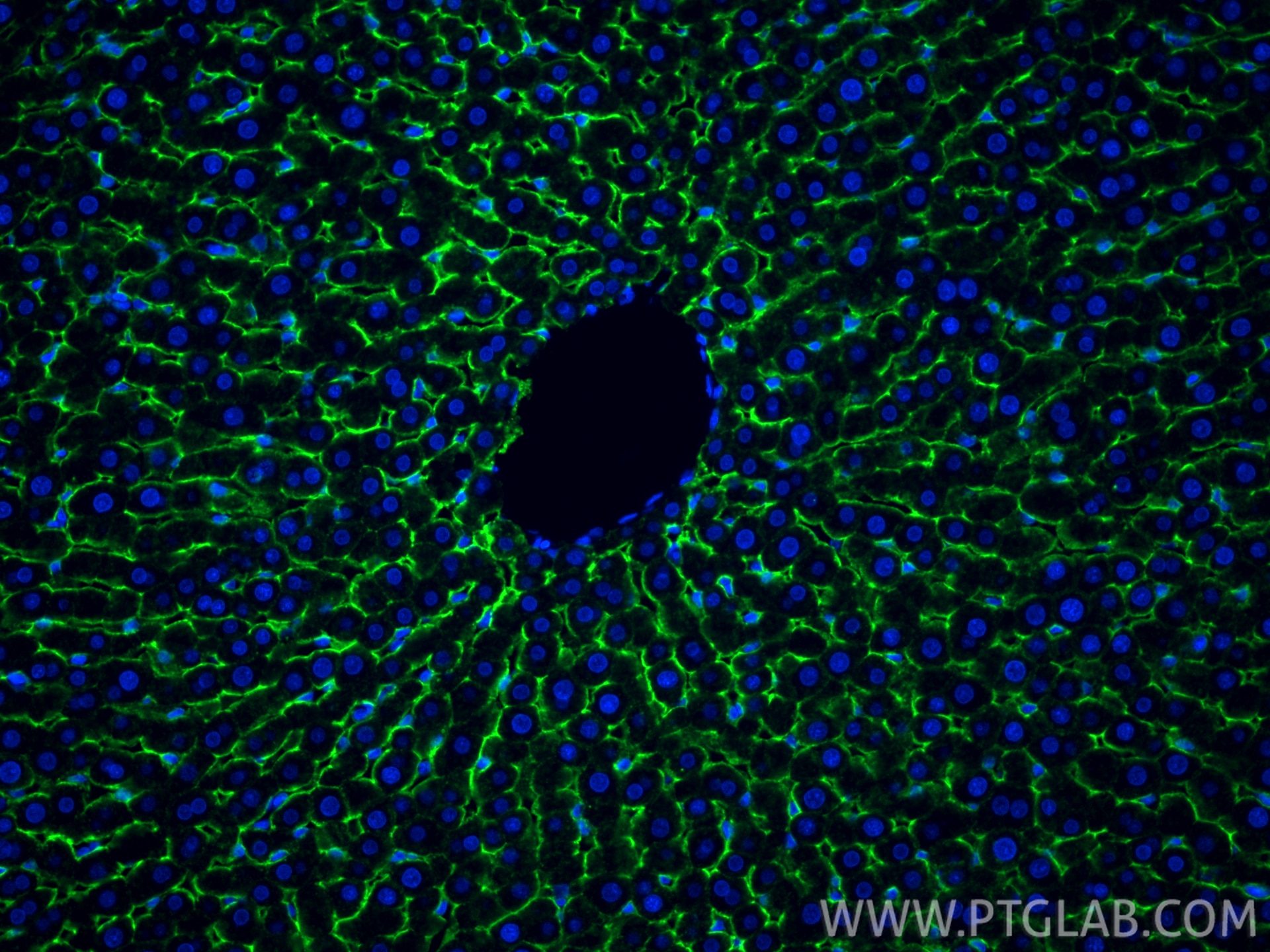 Immunofluorescence (IF) / fluorescent staining of rat liver tissue using ASGR1 Recombinant antibody (83691-3-RR)