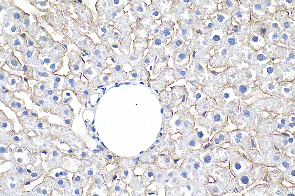 Immunohistochemistry (IHC) staining of rat liver tissue using Biotin-conjugated ASGR1 Polyclonal antibody (Biotin-11739)