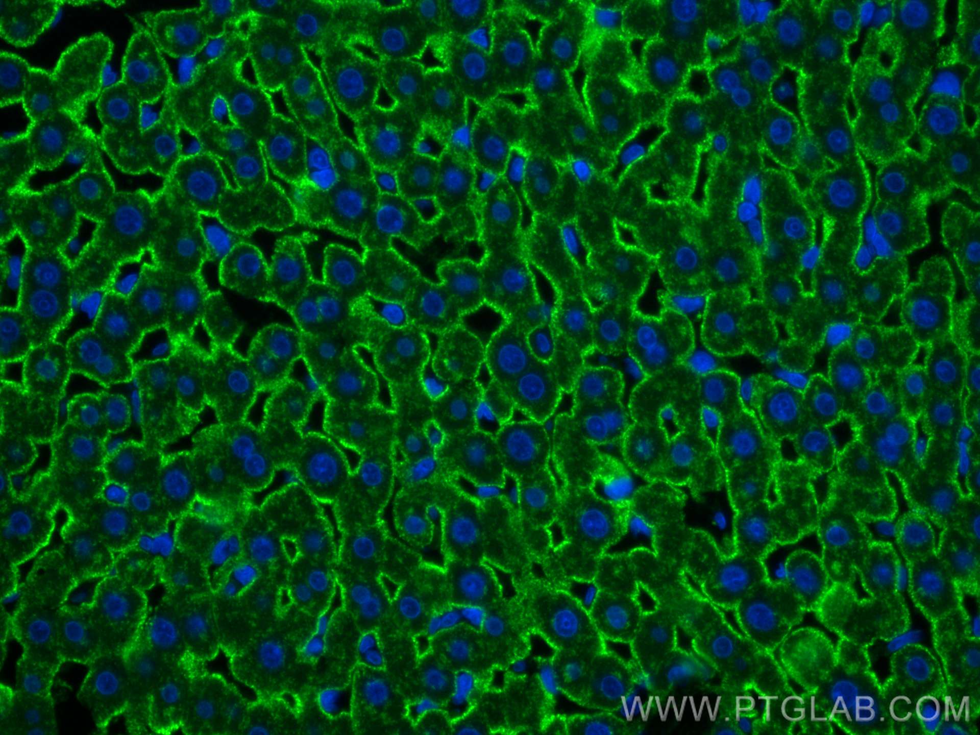 Immunofluorescence (IF) / fluorescent staining of rat liver tissue using CoraLite® Plus 488-conjugated ASGR1 Polyclonal ant (CL488-11739)