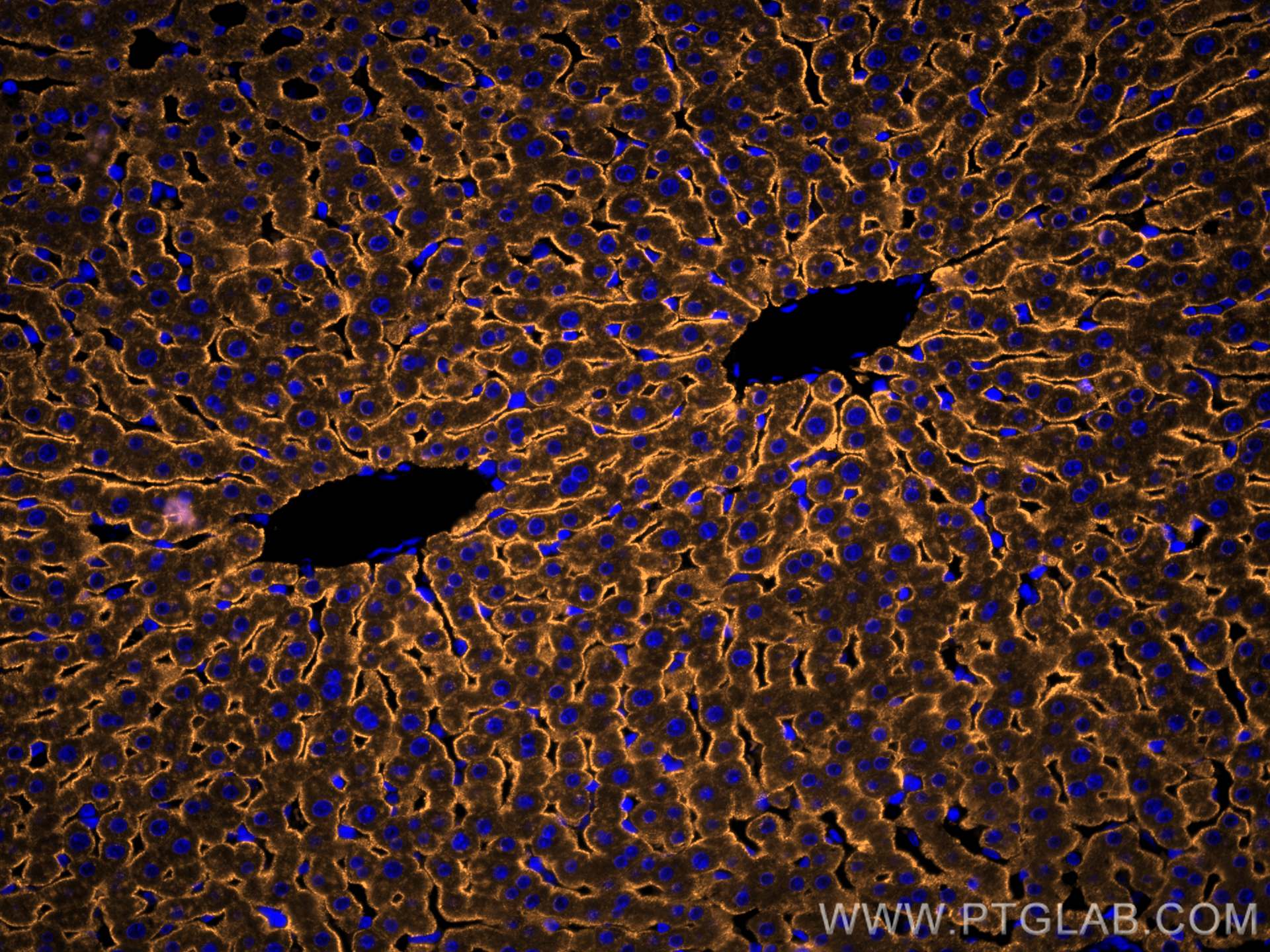 Immunofluorescence (IF) / fluorescent staining of rat liver tissue using CoraLite®555-conjugated ASGR1 Polyclonal antibody (CL555-11739)