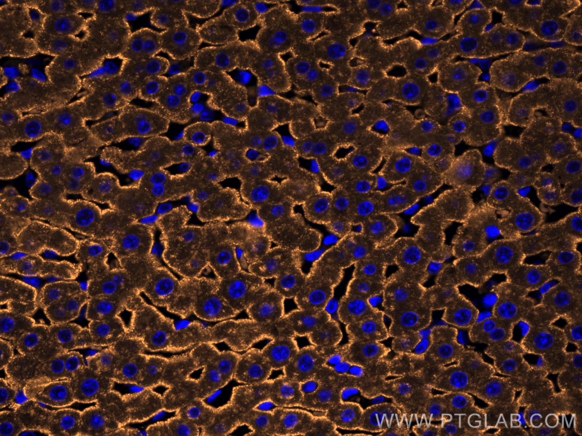 IF Staining of rat liver using CL555-11739