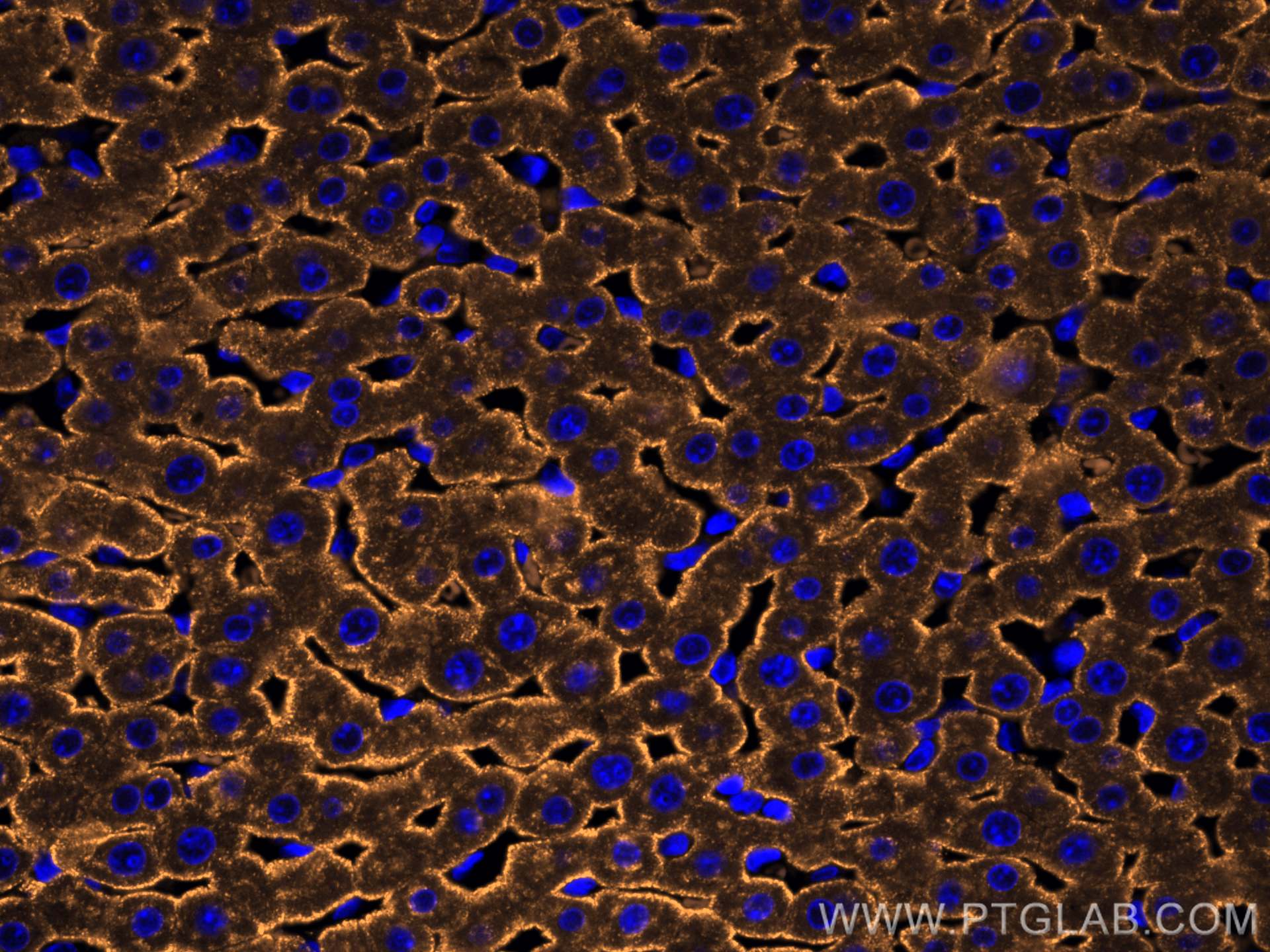 Immunofluorescence (IF) / fluorescent staining of rat liver tissue using CoraLite®555-conjugated ASGR1 Polyclonal antibody (CL555-11739)