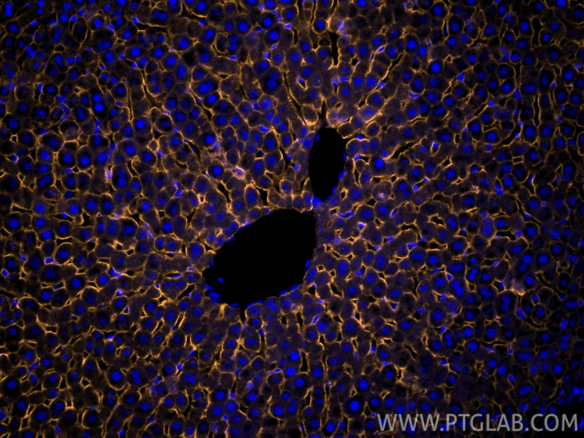 Immunofluorescence (IF) / fluorescent staining of rat liver tissue using CoraLite® Plus 555-conjugated ASGR1 Recombinant mo (CL555-83691-3)