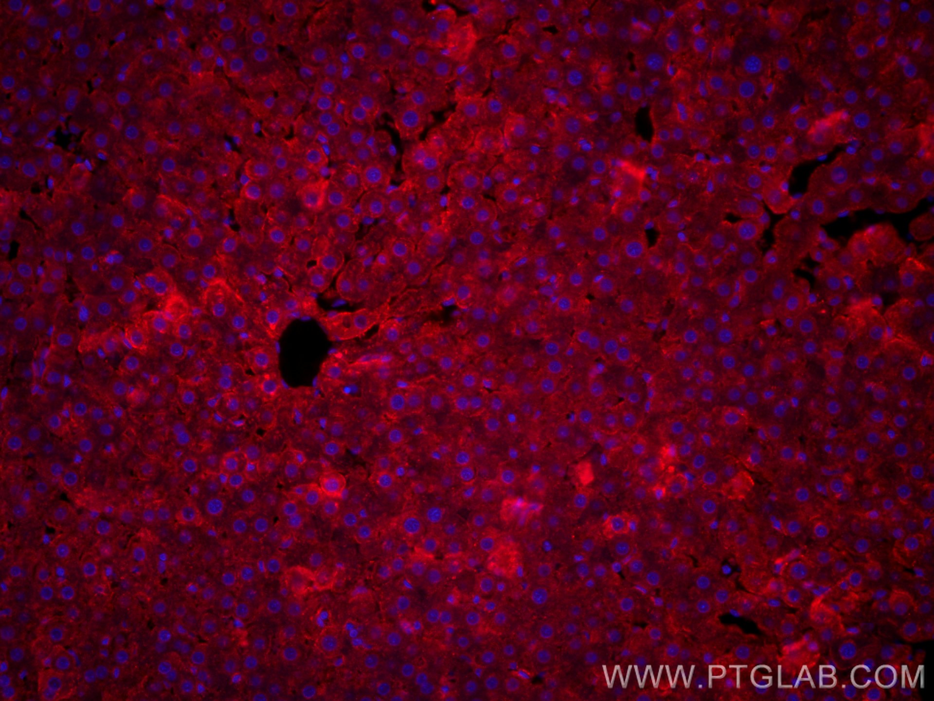 IF Staining of rat liver using CL594-11739