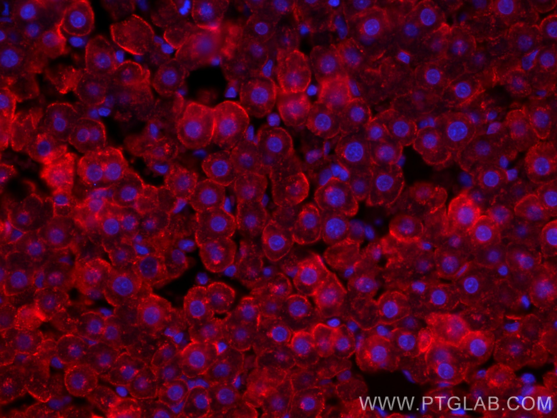 Immunofluorescence (IF) / fluorescent staining of rat liver tissue using CoraLite®594-conjugated ASGR1 Polyclonal antibody (CL594-11739)