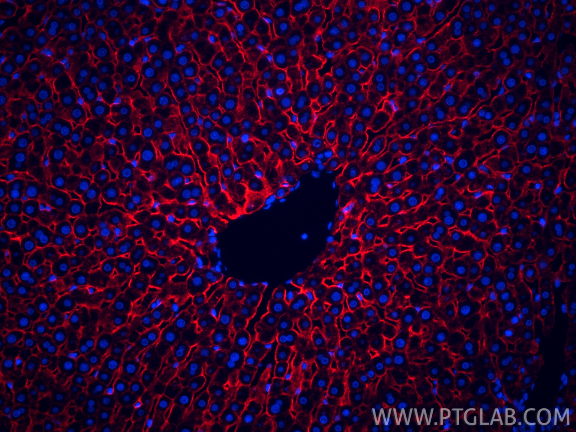 Immunofluorescence (IF) / fluorescent staining of rat liver tissue using CoraLite®594-conjugated ASGR1 Recombinant monoclon (CL594-83691-3)