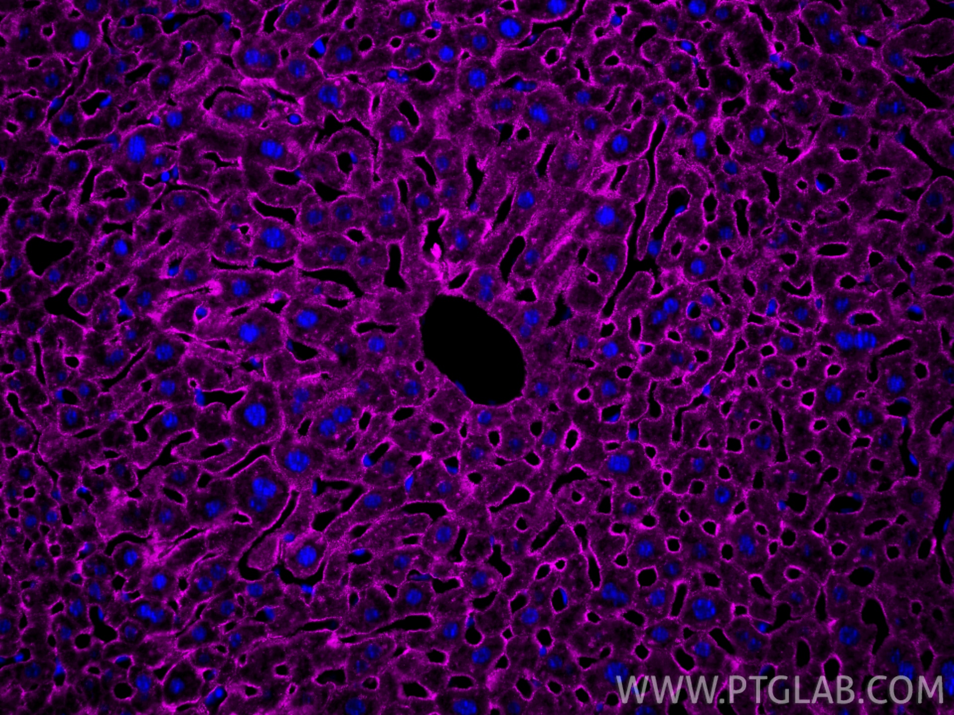 Immunofluorescence (IF) / fluorescent staining of mouse liver tissue using CoraLite® Plus 647-conjugated ASGR1 Polyclonal ant (CL647-11739)