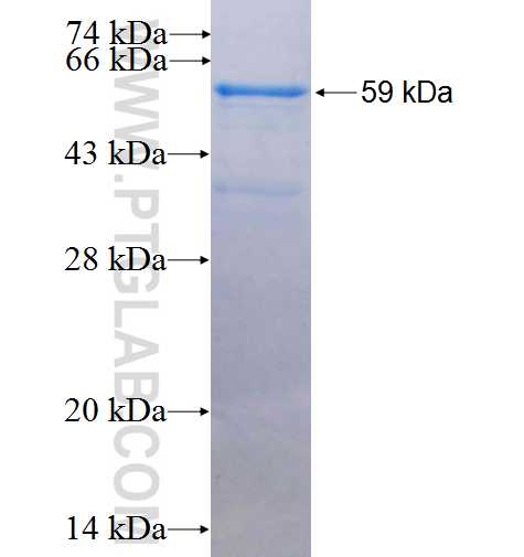 ASGR1 fusion protein Ag2310 SDS-PAGE
