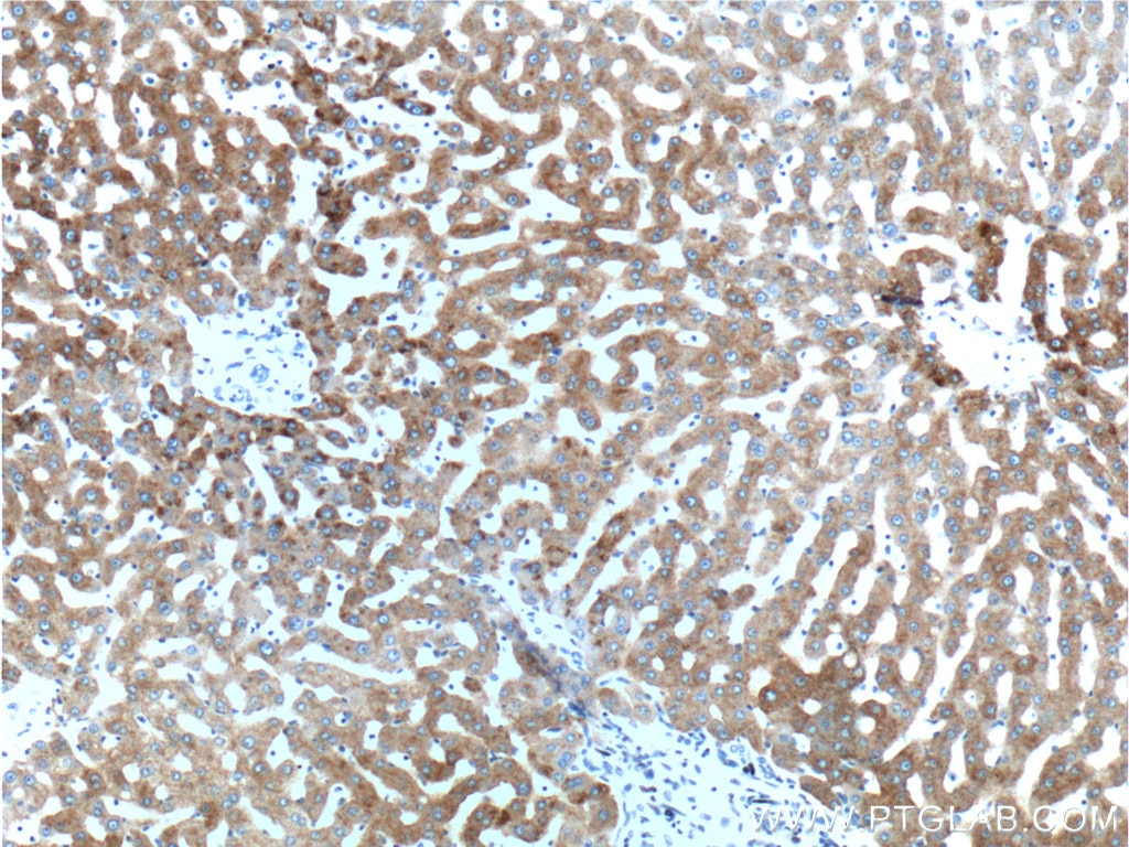 Immunohistochemistry (IHC) staining of human liver tissue using ASGR2 Polyclonal antibody (11501-2-AP)