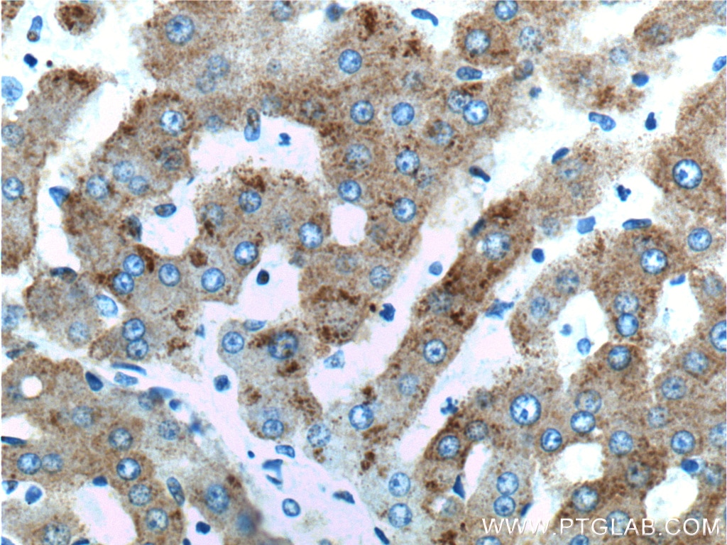 IHC staining of human liver using 11501-2-AP