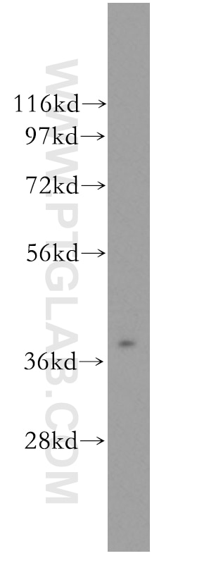 Western Blot (WB) analysis of human liver tissue using ASGR2 Polyclonal antibody (11501-2-AP)