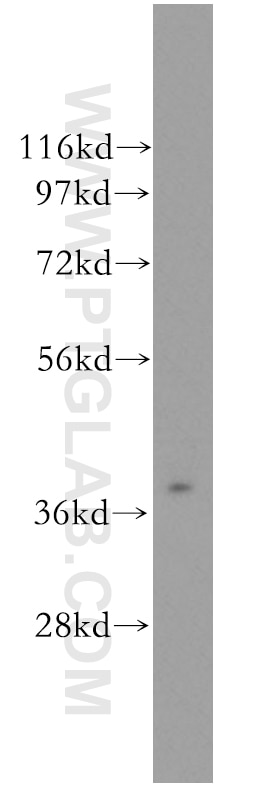 WB analysis of human liver using 11501-2-AP