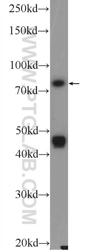 Western Blot (WB) analysis of COLO 320 cells using ASH2L Polyclonal antibody (12331-1-AP)